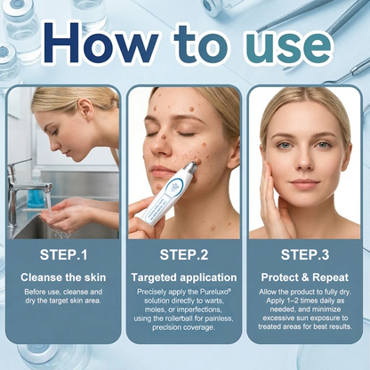 Quillanco® Skin Tag Remover Roller🌟🏆