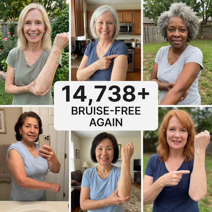 ⭐ Trusted by 100,000+ Customers – Quietqi Bruise Recovery Cream